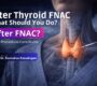 After Thyroid FNAC What Should You Do 90x80