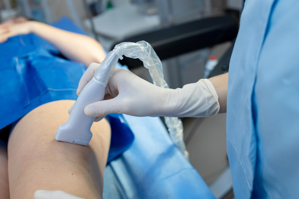 Hospital procedure image of Varicose Vein Treatment Without Surgery using laser technology EVLT