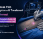 Varicose Vein Symptoms Treatment in Chennai The Complete Guide to Minimally Invasive Care 90x80