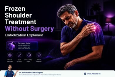 Frozen Shoulder Embolization