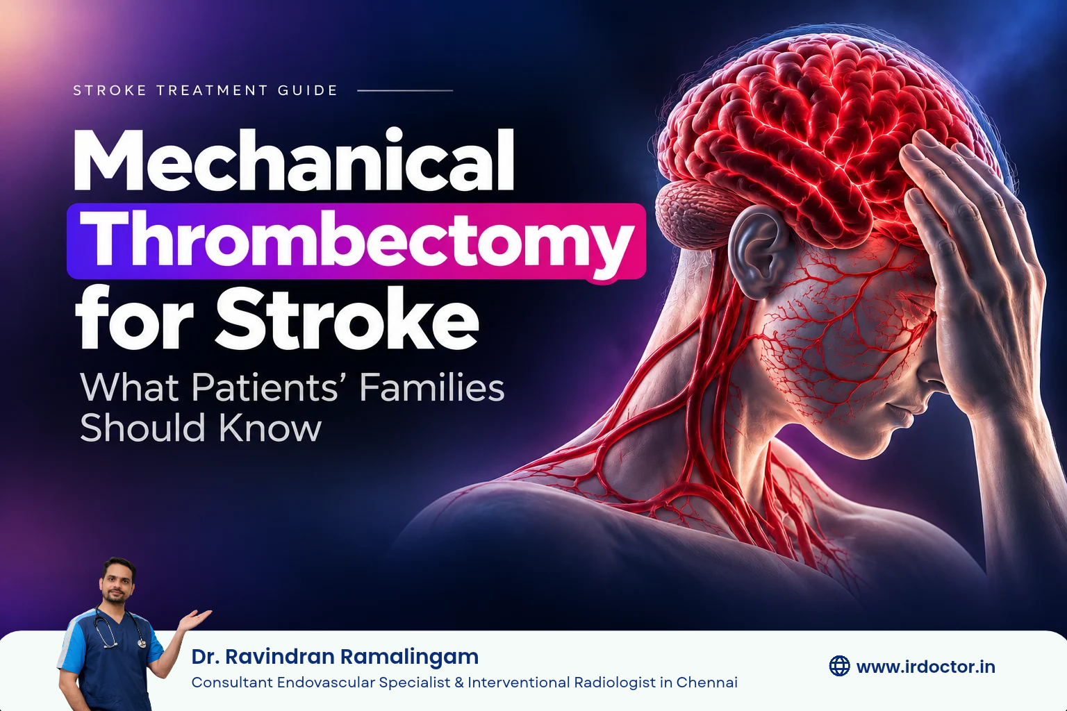 Mechanical thrombectomy for stroke: catheter-based clot removal treatment